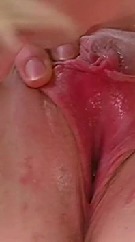 Dirty doc vuole scopare oggi