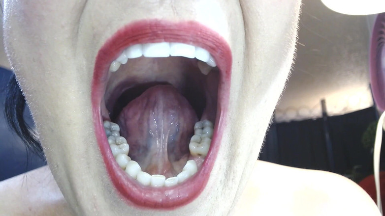 Abby Anna: Dentro de mi gran boca, úvula de dientes de lengua