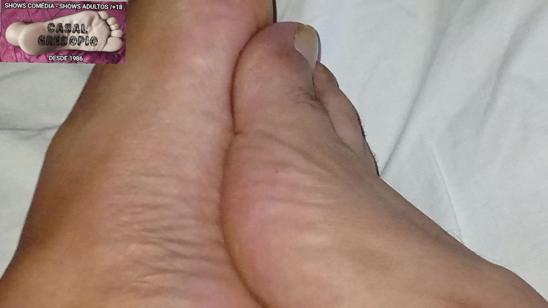 Casal Gresopio Male: Gresopio Pada Kaki Lelaki 16
