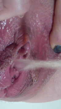 Plastijd