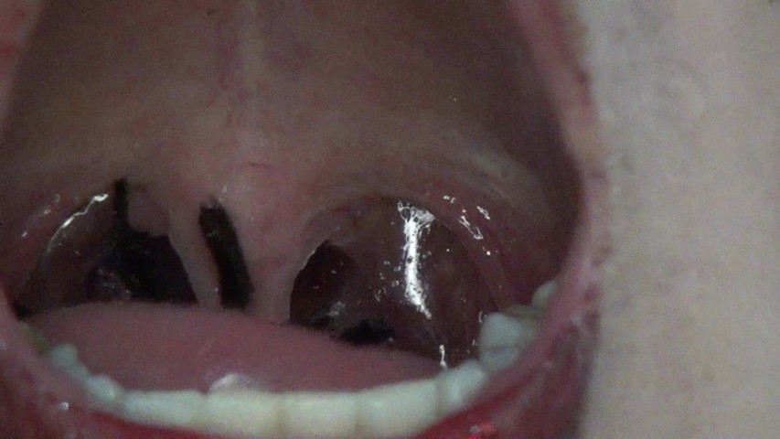 Super Spectacle Swallowing Big Spiders! (Angel eyes studio)