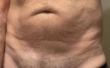 feedmedick: Hlazení ven