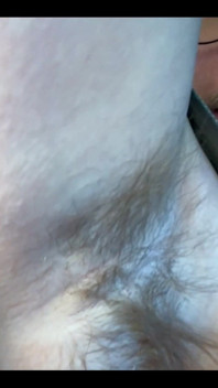 What Do You Think of My Hairy Armpits?