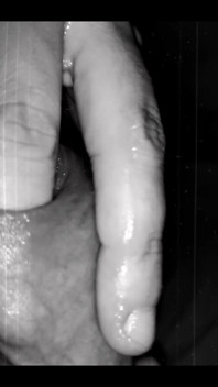 Foreskin Play