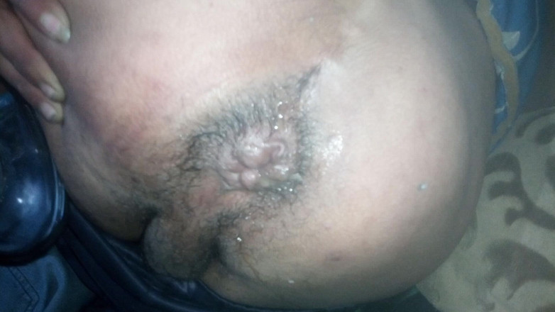 Vane_69_anal: Expansion, partie 1