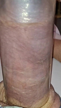 Bomba