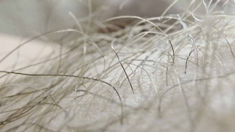 Nalekhome: Kontolku di makro