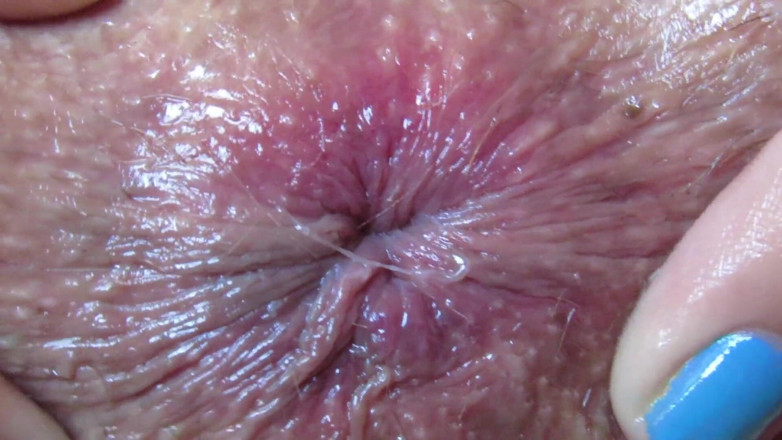 Cuteblonde666: Close up anal play deep fingering asshole fetish