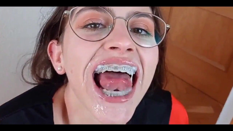 Shanaxnow: Please Cum on My Braces Dirty Talking Teen Blowjob. Shanaxnow