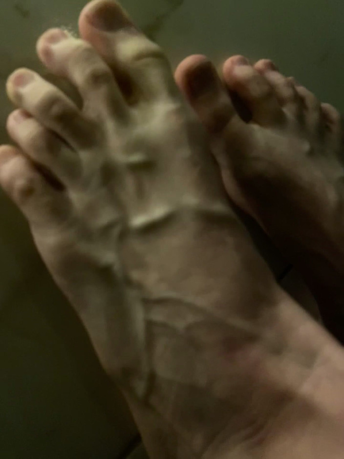 Princess Aisha: So Swollen Veins on the Feet