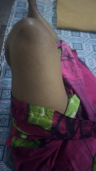 Hot Leg