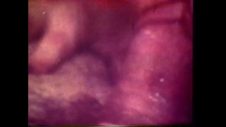 Vintage Megastore Full hd: Doktor hastayı kontrol ediyor