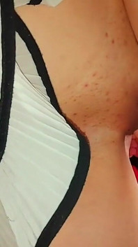 ¡la Hermanastra Salta Sobre Mi Brazo!