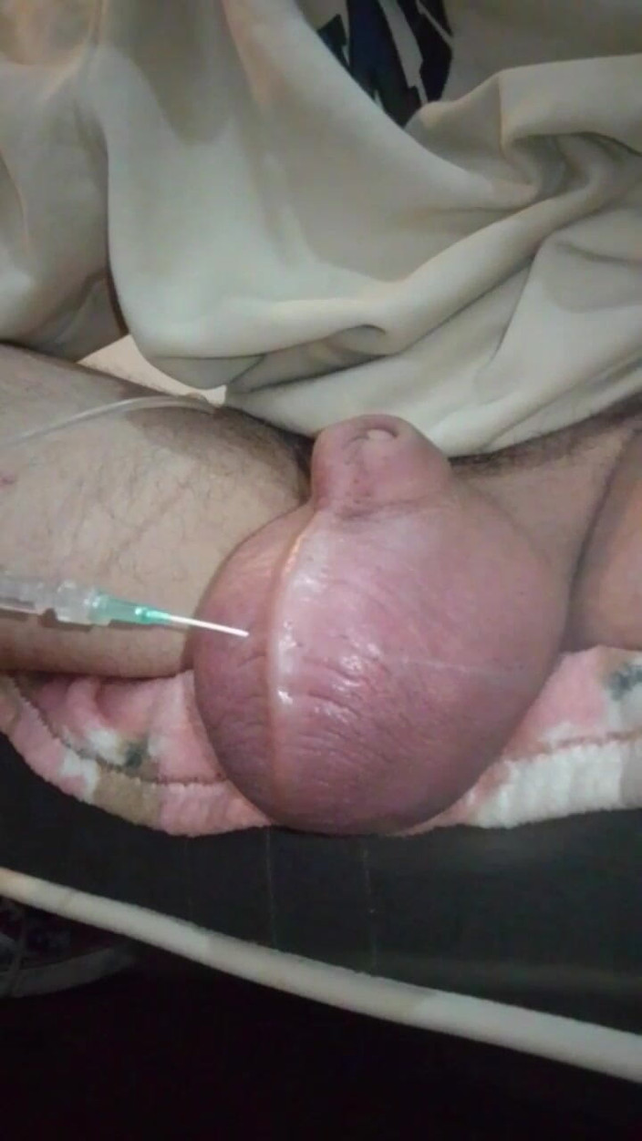 Ryan Honda: Je donne une bonne alimentation à mon pamplemousse