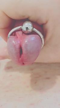 Paja y dilatación uretral