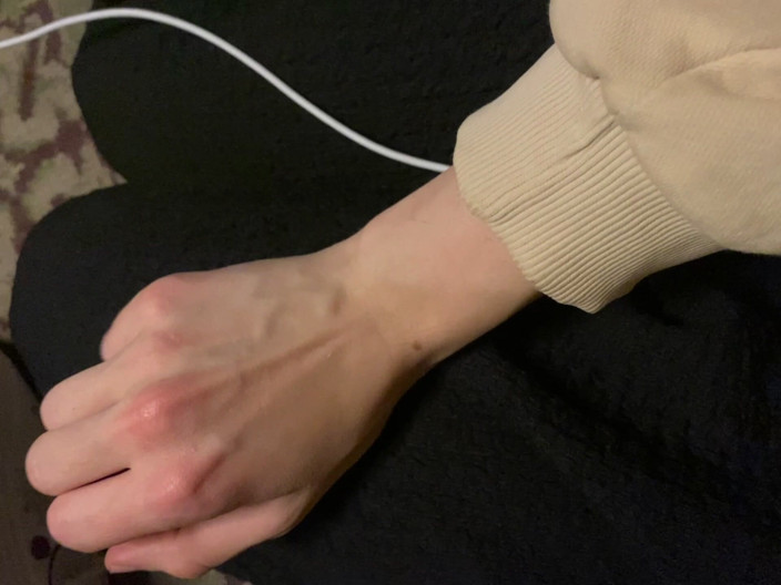 Princess Aisha: Tangan Veiny Berhampiran Pemanas