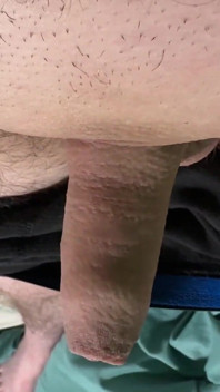 Rubbing My Uncut Cock