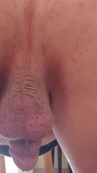 Lỗ đít của mẹ kế