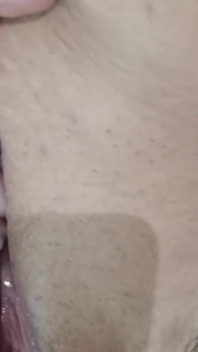 His Hands All in That Juicy Pussy She Squirts on Her Fupa He Licks It up Supadupa