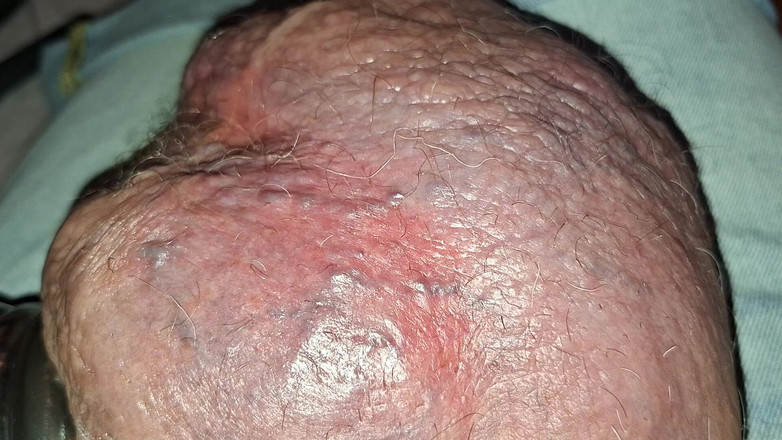 Monster_Meat_: Голый монстр