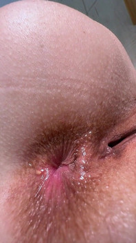 He Inflated My Ass Like a Sail! the Anal Opened and He Smelled the Food He Treated Me to at the Cafe Today.