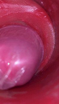 Camera Inside Pussy: Powerfull Cum in Pussy! Best Internal Asmr in 4K More Sperm