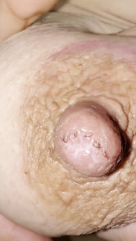 Cracked Nipples Part 2 Sucking My Milk
