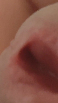 Amazing Closeup of the Widened Hole!!