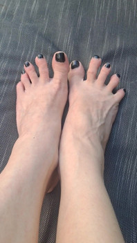 Do We See How Beguiled My Throbbing Foot Veins Are
