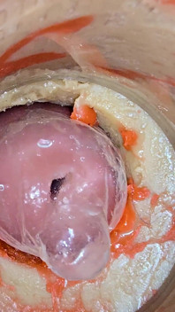 The Camera 4K Inside the Deep Pussy Records a Huge Ejaculation with a Stuck Condom