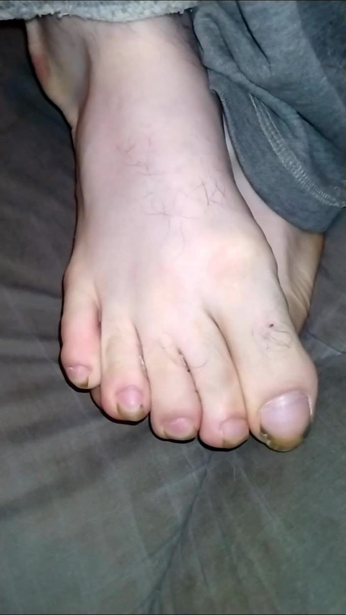 Au79: Foot Fancies