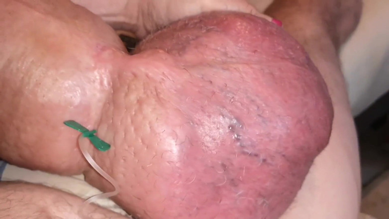 Monster_Meat_: Una massiccia coltivazione del glucosio