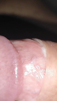 Incredible Cock, Unique of Slippery Phimosis by the Robust Body.