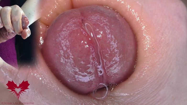 Close Up Extreme: Super Close-up of the Glans. Urethral Games with the Dilator.