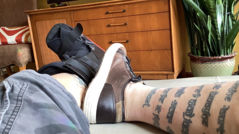 City hog: broken leg fetish