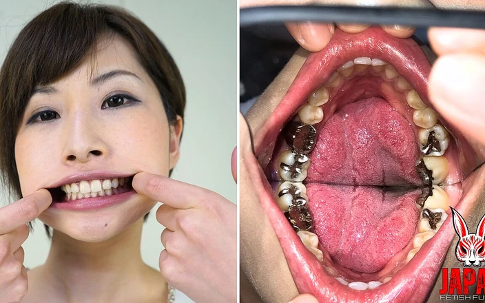 Japan Fetish Fusion: Teeth Inspection Chronicles: Dive Into Yua Hidaka's Enigmatic Oral Realm