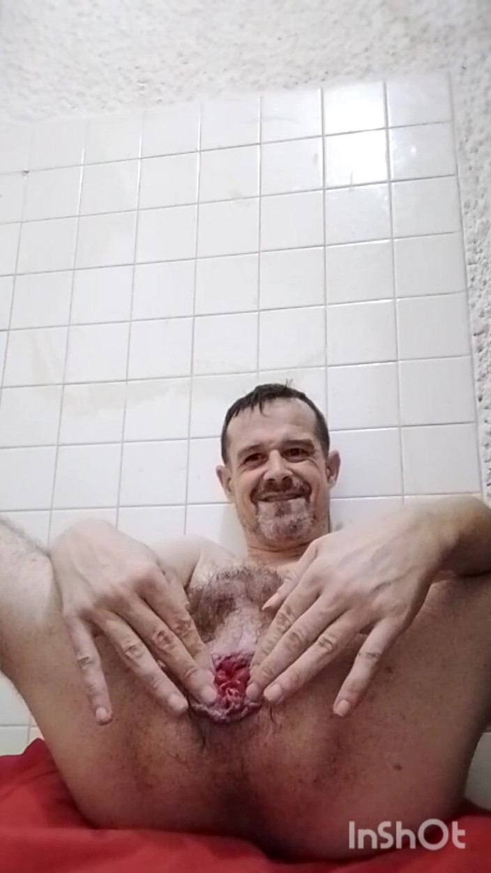 Andres Monoflaco: Biggest Prolapse yet