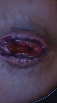 My Hole