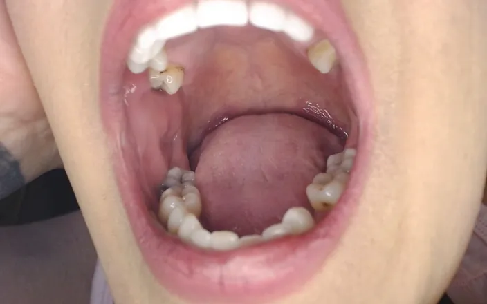 Abby Anna: Tongue Twisting Flipping Slapping Closeup Rapid Slap