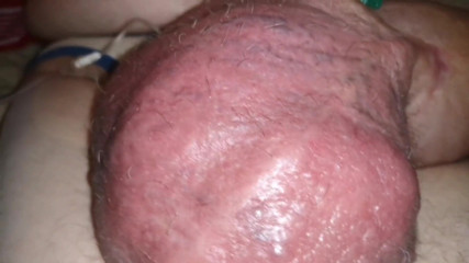 Monster_Meat_: Filling up again with glucose after pumping