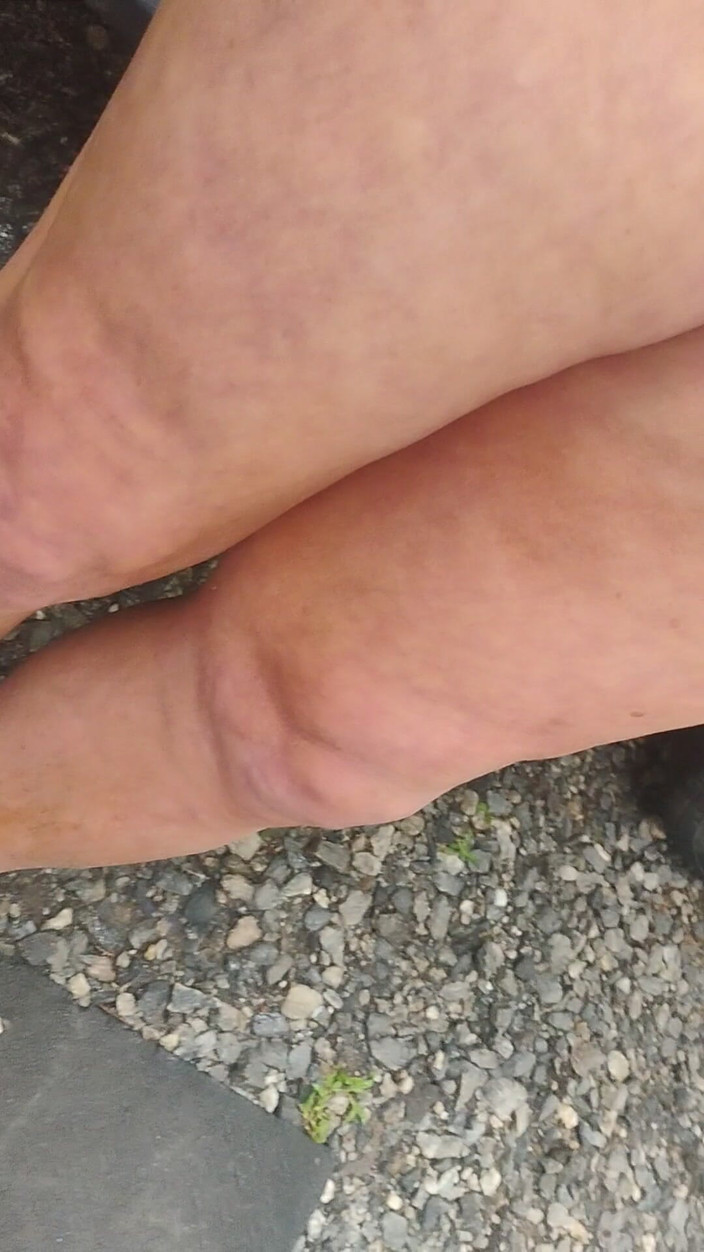 Lolatmylilpeepee: Exposure of Tiny Cock
