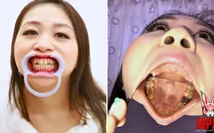 Dental Exploration: Rin Suzumiya's Oral Adventure