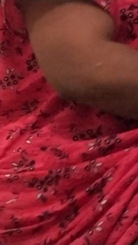 Hot Leg