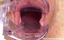 Mature Gyno Exam: Cervix of Shy MILF Revealed!