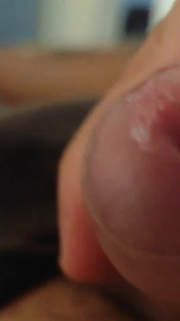 Great Phimosis Getting in the Way of the Boy's Orgasm