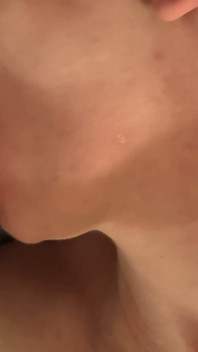 Massive German Cock Cum in Mouth