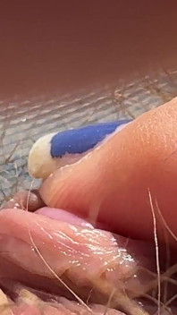 Amateur Hairy Girl Mastubates in Closeup with Huge Clit