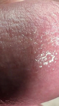 Sperm Close-up Front