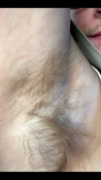 What Do You Think of My Hairy Armpits?