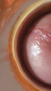 Boy Close up Tight Uncircumcised Glans Excited